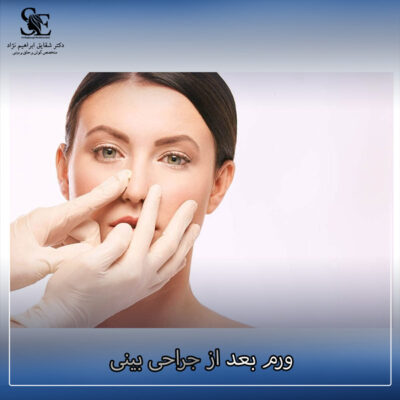 ورم بعد از جراحی بینی - دکتر ابراهیم نژاد