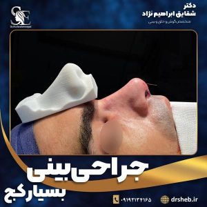 جراحی-بینی-16