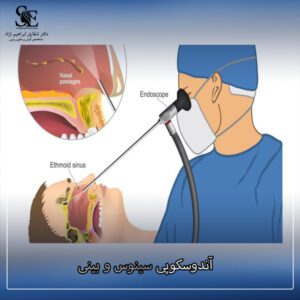 آندوسکوپی سینوس و بینی - دکتر ابراهیم نژاد