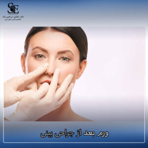 ورم بعد از جراحی بینی - دکتر ابراهیم نژاد