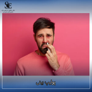 پولیپ بینی - دکتر ابراهیم نژاد